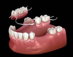 Complete & Partial Denture