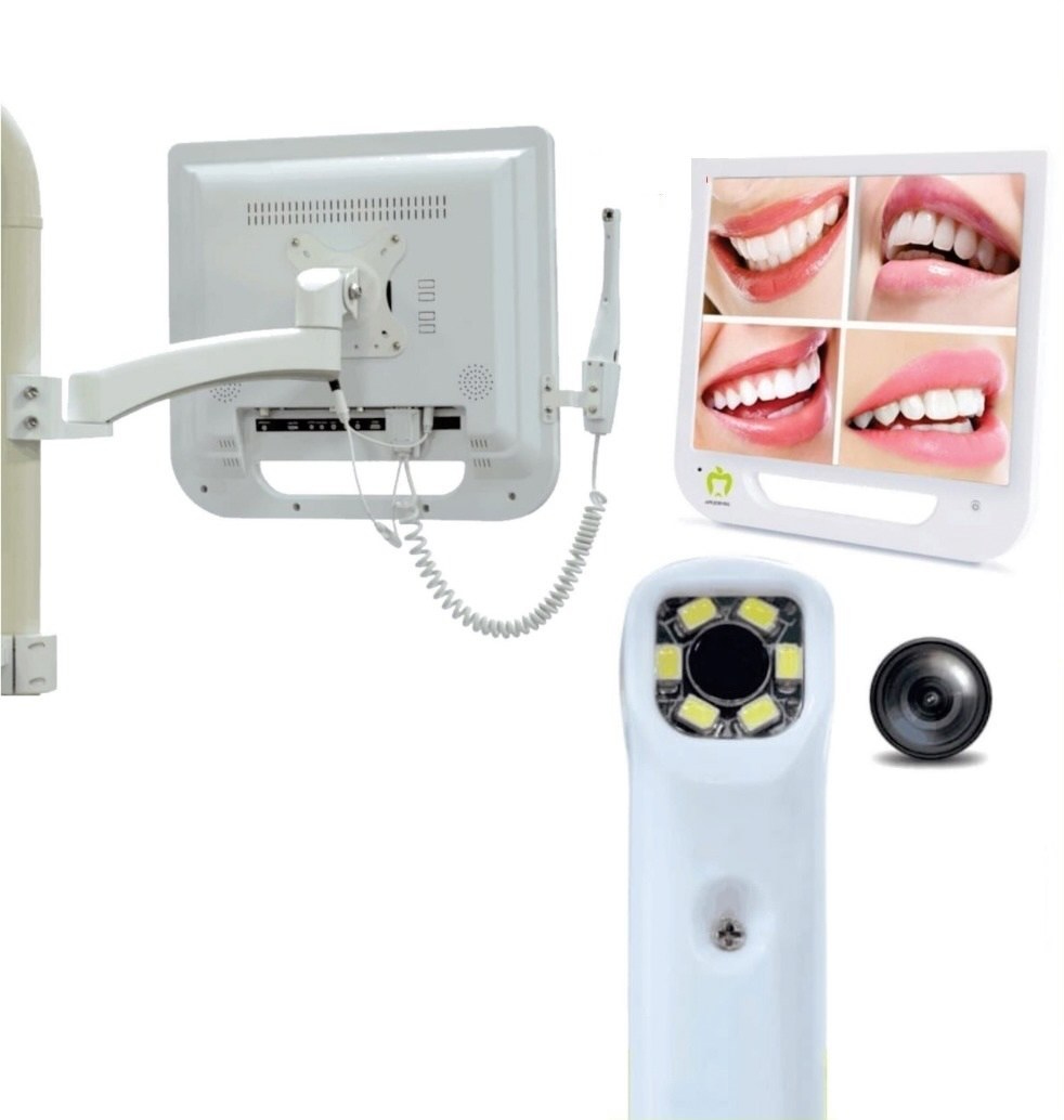 Intra Oral Camera